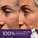 Sérum Redutor Instantâneo de Linhas – Le Moritz – Efeito Lifting Imediato