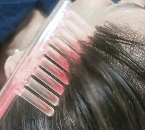 Derma Capilar ProPente – Crescimento e Força